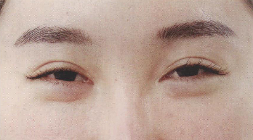 形變和移位